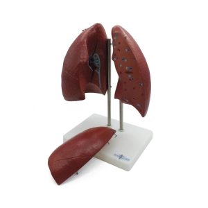 PULMONES DE TAMAÑO NATURAL EN 4 PARTES – XCH-XC-321