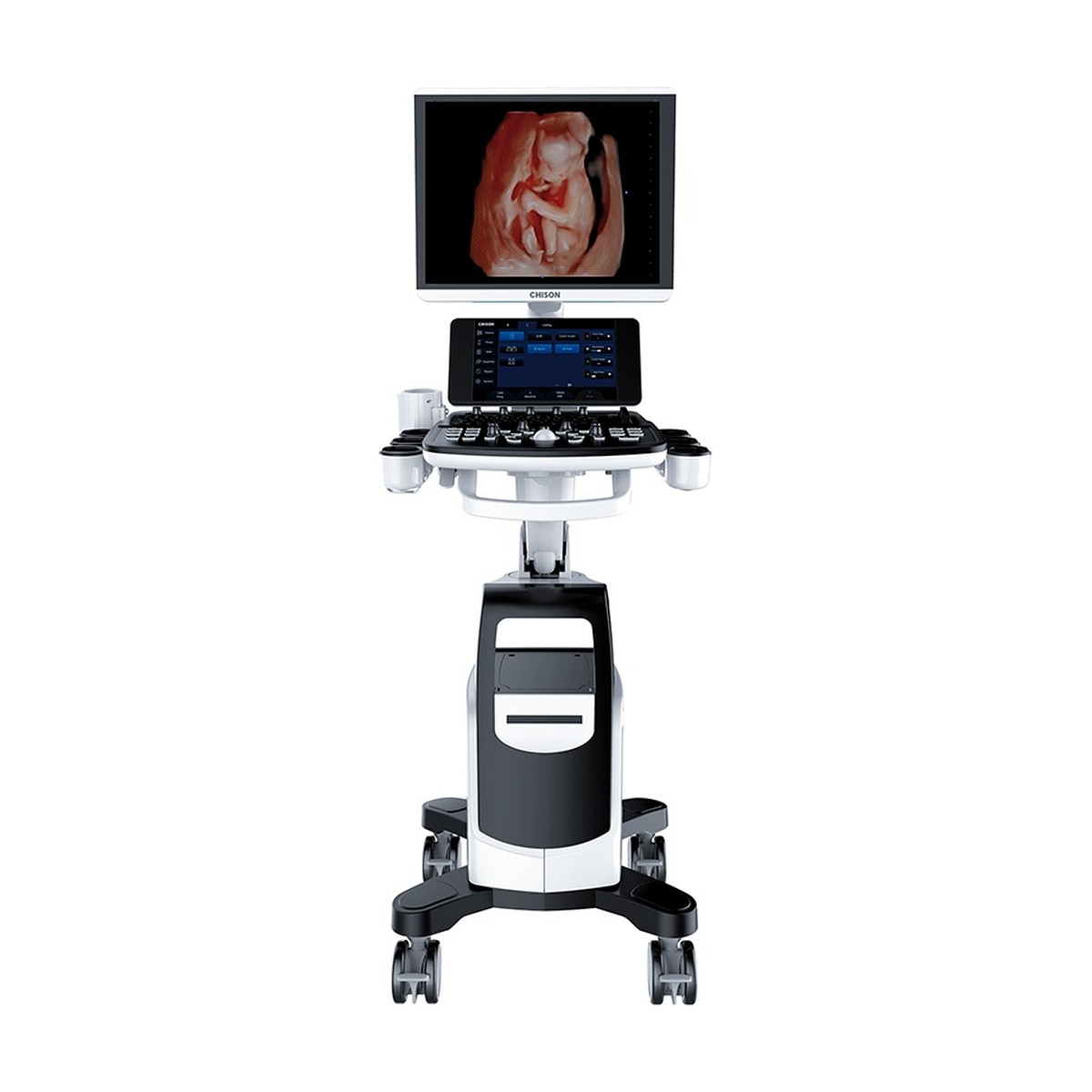 Ultrasonido CHISON CBit 8 con 3 transductores: convexo, lineal y vaginal