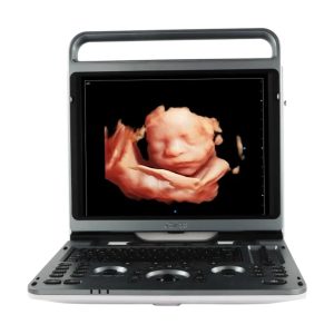 Ultrasonido CHISON EBit 50 con 3 transductores: convexo, lineal y vaginal