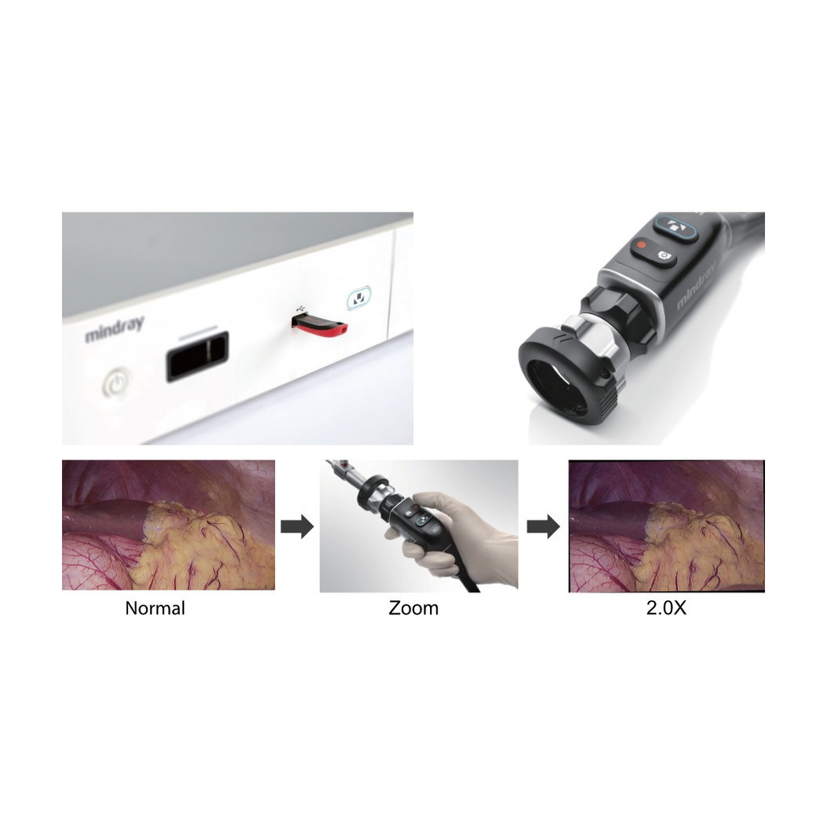 Sistema de cámara endoscópica Full HD Mindray HD3
