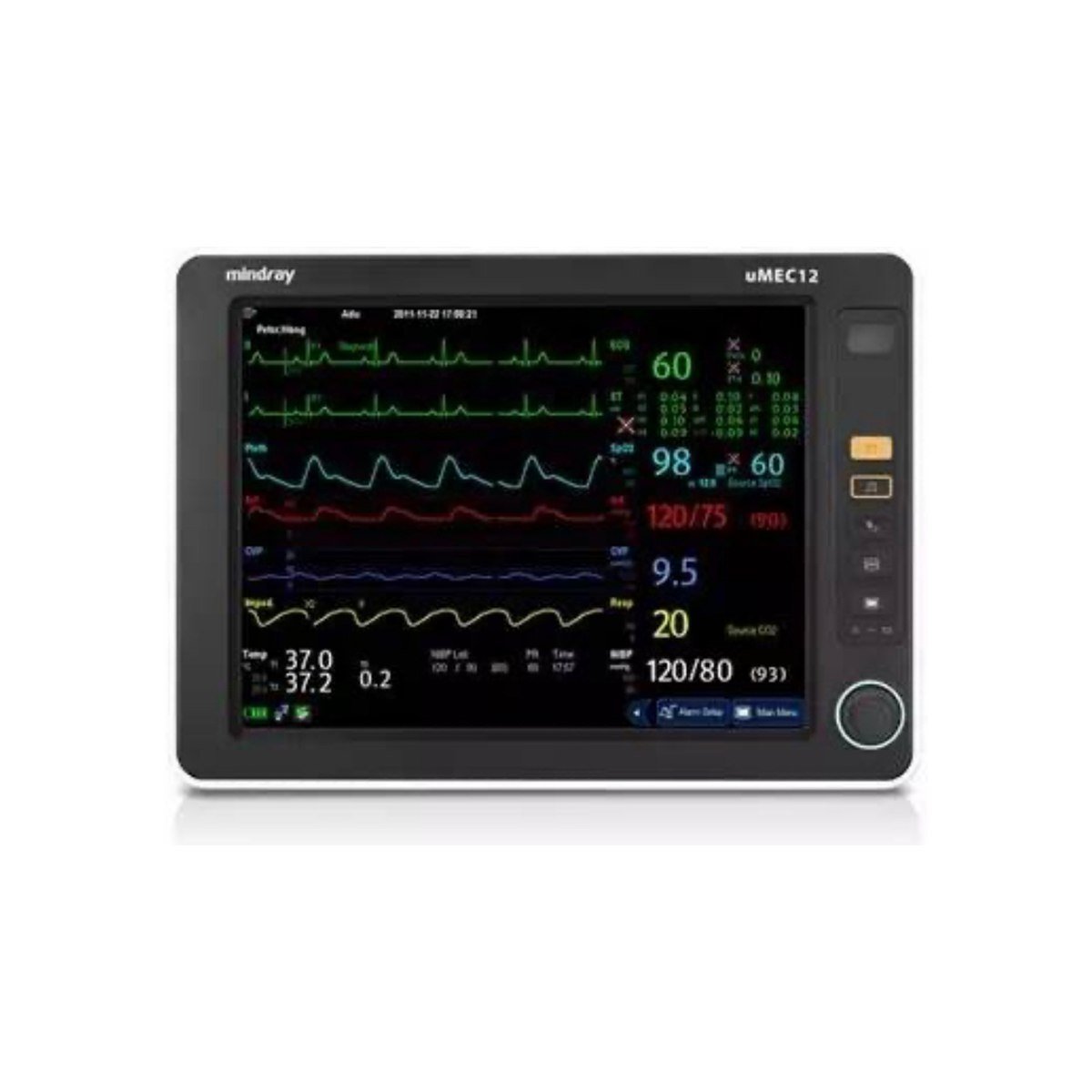 Monitor de signos vitales Mindray uMEC12 con capnografía
