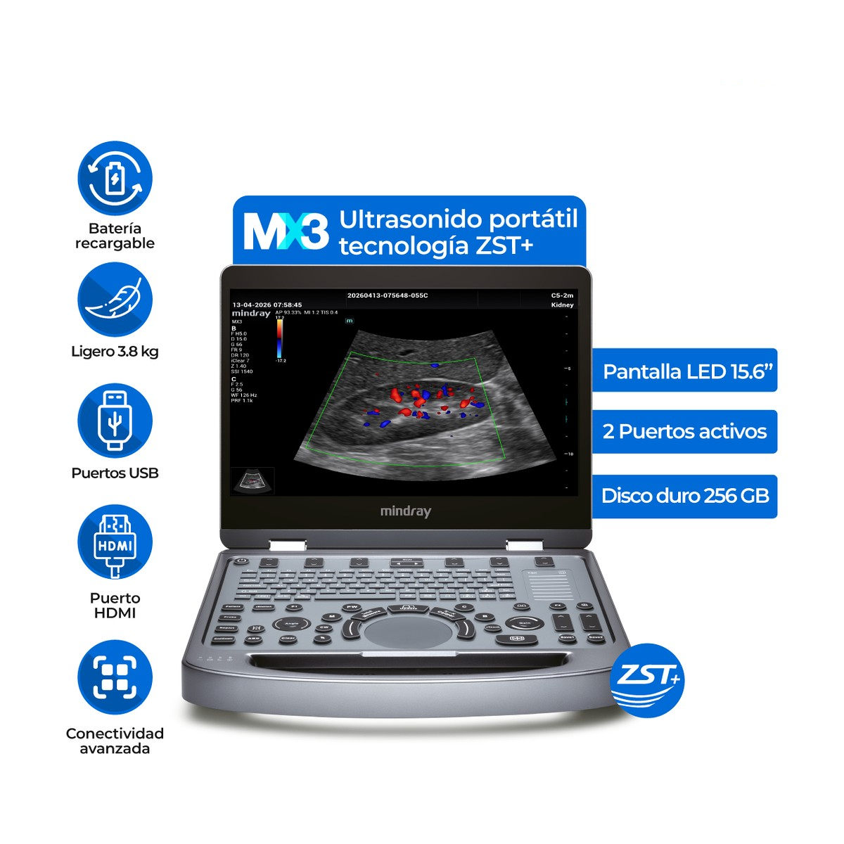 Ultrasonido portátil Mindray MX3 | Convexo