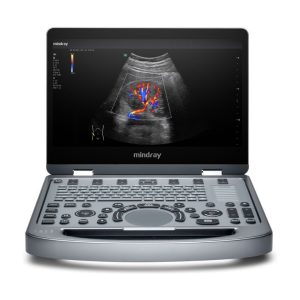 Ultrasonido portátil Mindray MX6 con transductor convexo y lineal