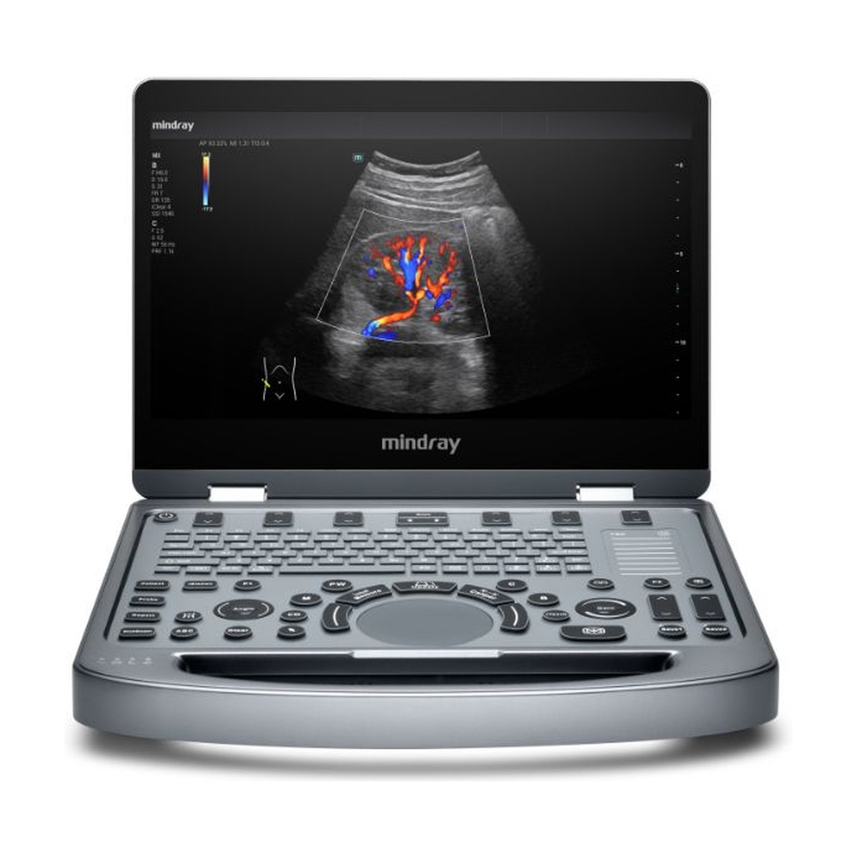 Ultrasonido portátil Mindray MX6 con transductor convexo y lineal